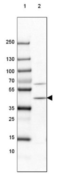 PHYH Antibody, Novus Biologicals:Antibodies:Primary Antibodies
